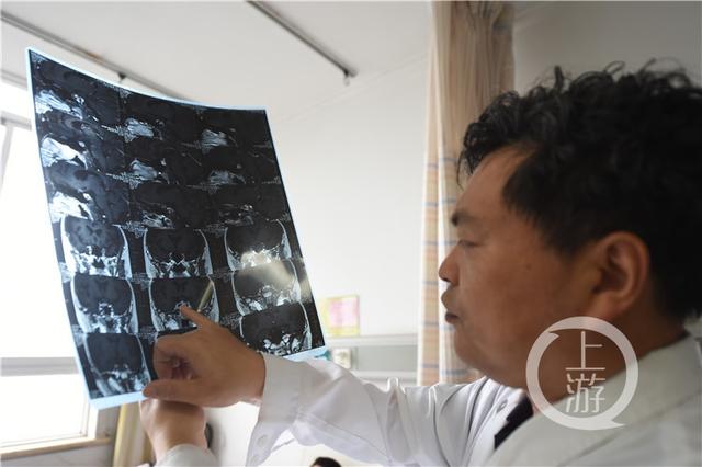 医生误开癫痫药给6岁女童吃是怎么回事