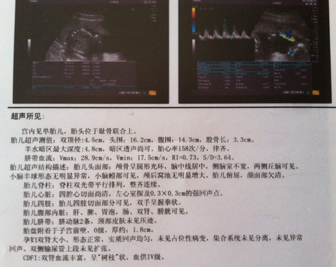 怀孕6周适合吃的食物有哪些