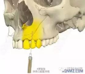 孩子全身麻醉治疗牙齿有危险吗