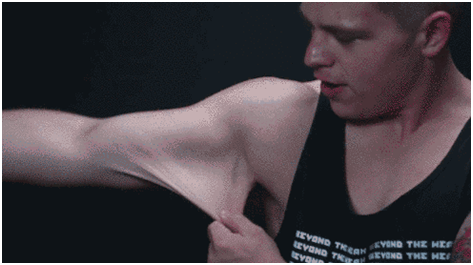 减肥后皮肤会松弛吗 减肥后皮肤会松弛吗