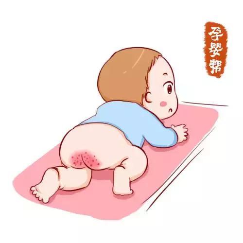 宝宝皮肤如何护理