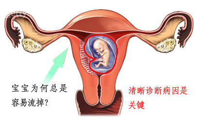 习惯性流产流走好“孕”气，责任在谁