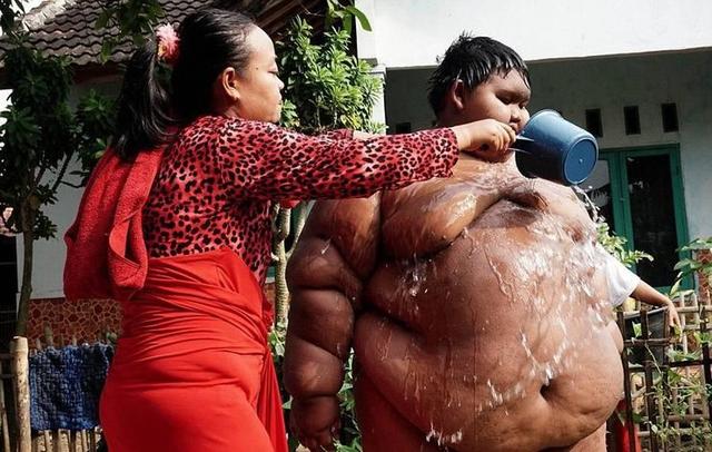 孩子这样其实是中暑了