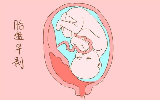 帮助孕妈咪们区别宝宝到底是打嗝还是胎动