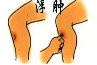 宝宝排尿次数多怎么办