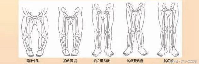 宝宝睡觉青蛙腿怎么回事