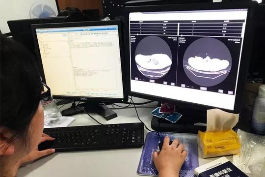 留美博士辍学创业做人工智能，融资近2亿掘金4000亿医疗影像市场