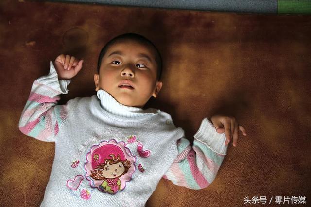 孩子得了脑瘫能治好吗