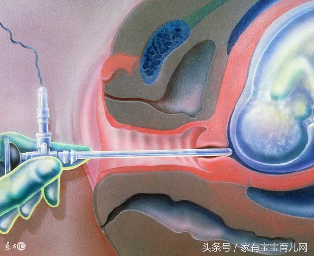 不想生畸形儿？孕期这6项检查一定要做