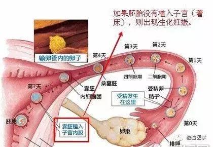 精卵好不容易成功结合却不着床，这是怎么回事