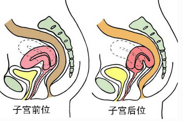 子宫后位怀孕难吗