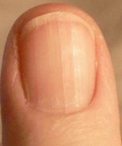 婴儿生病严重的6种情况 婴儿生病严重的6种情况