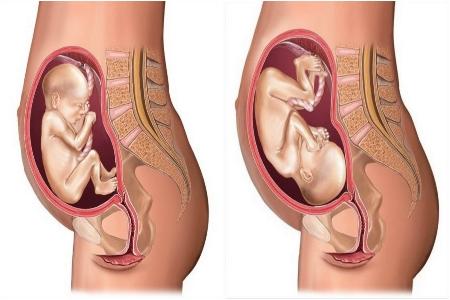 怎么判断胎儿位置的方法