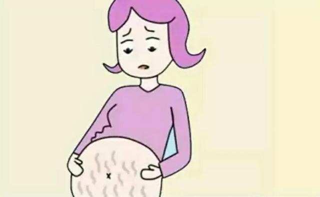 妈妈有妊娠纹会遗传吗