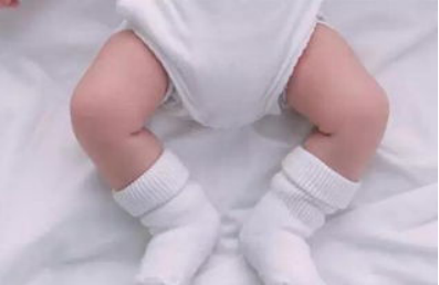 穿纸尿裤会让孩子O型腿吗