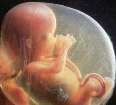 胎儿停止发育的症状特征是什么