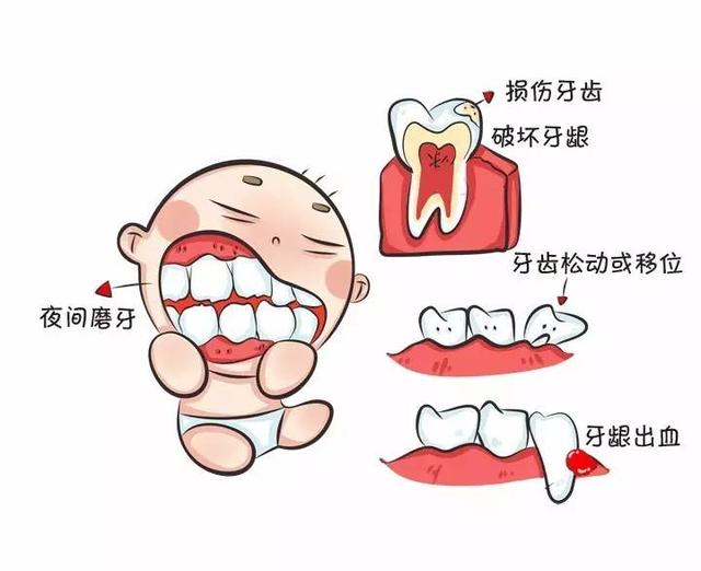 宝宝三岁睡觉的时候磨牙怎么办