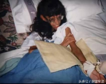 了解免疫低下的分类