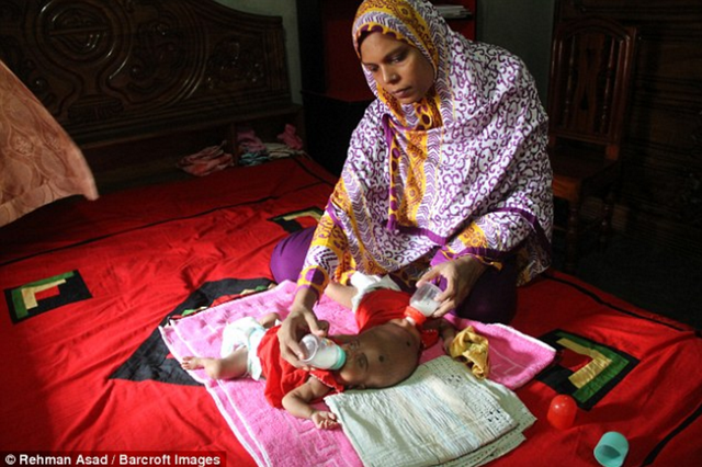 双胞胎应该分开哺乳吗