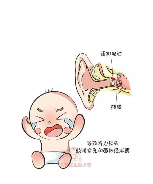 宝宝吃了纽扣电池怎么检查