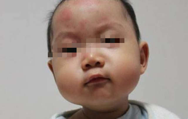 婴幼儿吃鸡蛋注意事项
