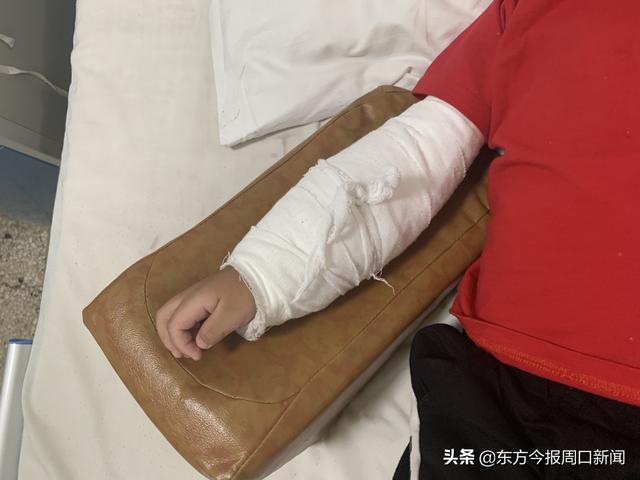 暑假最常见的儿童意外伤害