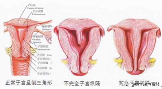 子宫小对生育有多大影响 子宫小对生育有多大影响