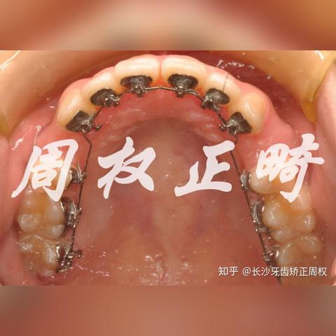 长沙哪里贴隐形车衣最好最便宜？