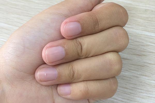 产后可以清洁这些部位吗