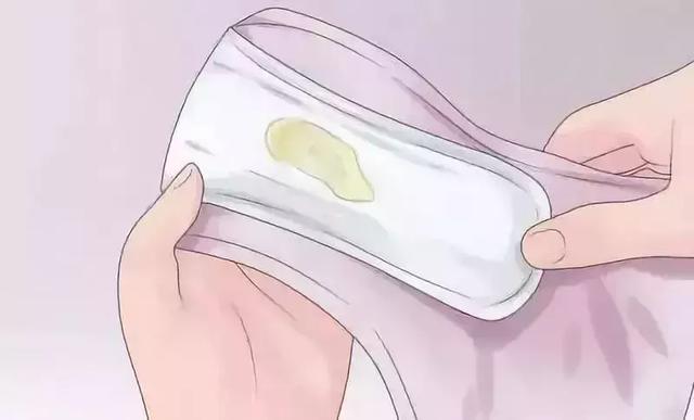 女性月经量多少正常 女性月经量多少正常