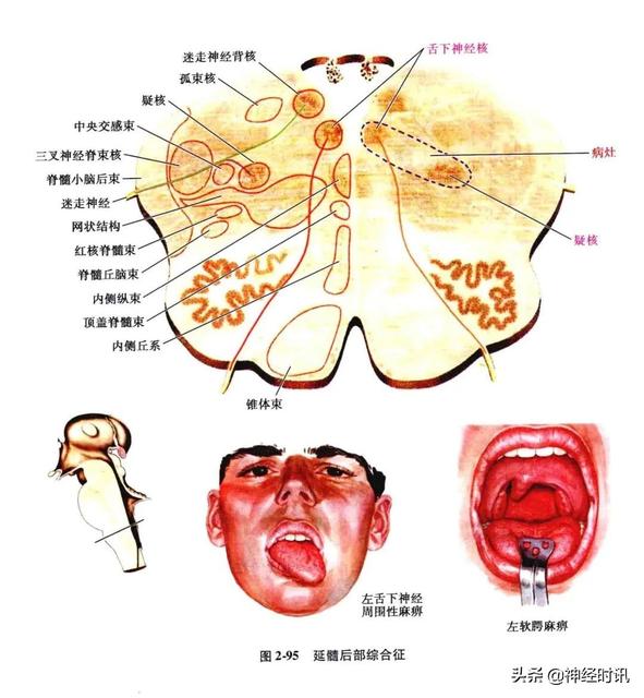 孩子触觉迟钝怎么办 孩子触觉迟钝怎么办