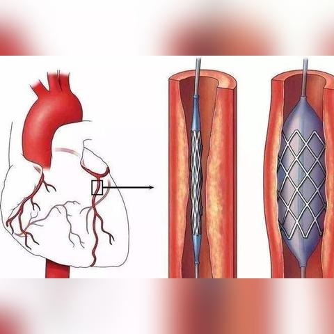 tiktok到底怎么读