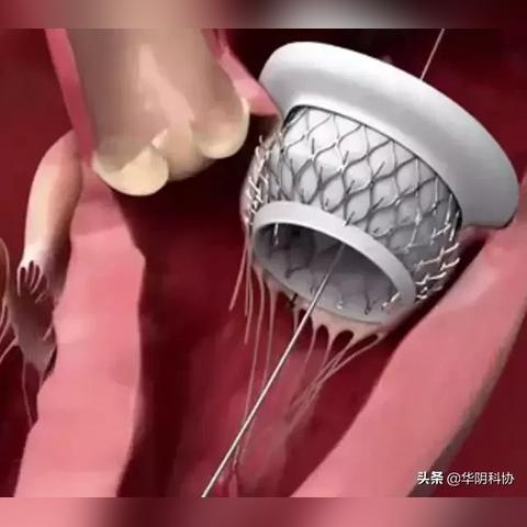 西安市第三医院做造影怎么样