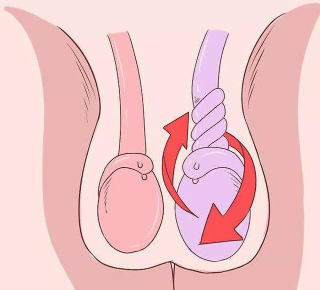 男宝私处常见问题汇总