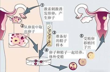 试管婴儿需要多长时间？