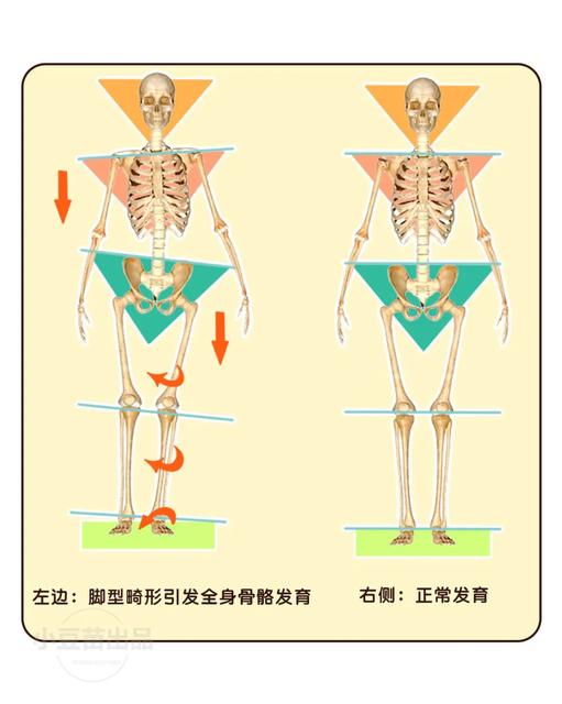 这些鞋不要给孩子穿伤害脚部发育