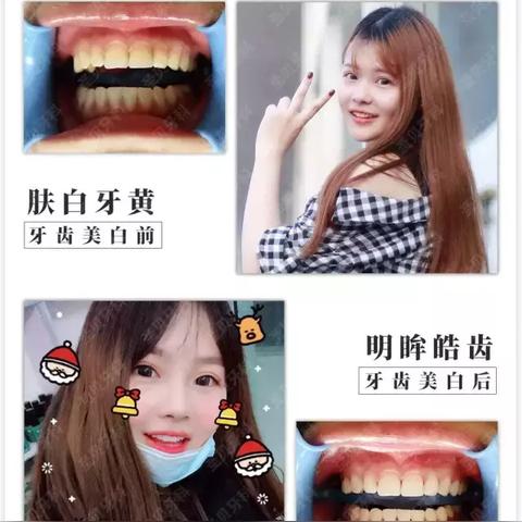 广州哪间公立医院整牙比较好？