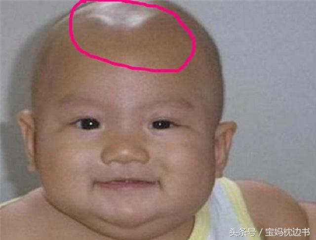 宝宝囟门凸起怎么回事