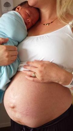 生完孩子就能瘦吗 生完孩子就能瘦吗