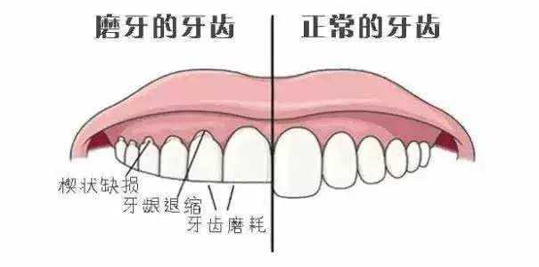 孩子晚上睡觉磨牙的原因