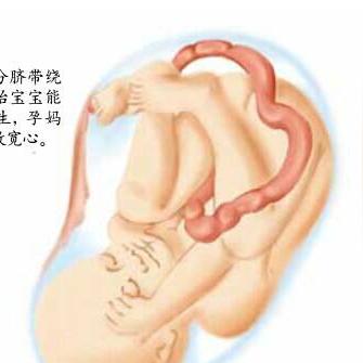 胎动减少要做什么检查的长尾关键词有哪些