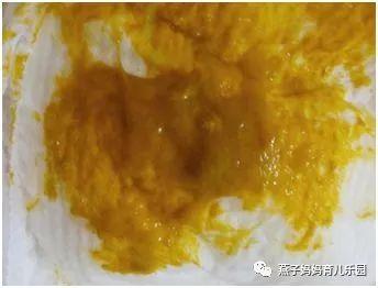 宝宝大便有泡沫怎么回事