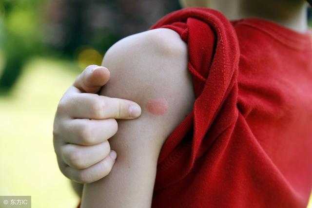 孕妇和宝宝为什么容易招蚊子 孕妇和宝宝为什么容易招蚊子