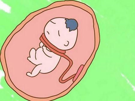孕期3个动作会增加胎儿绕颈几率