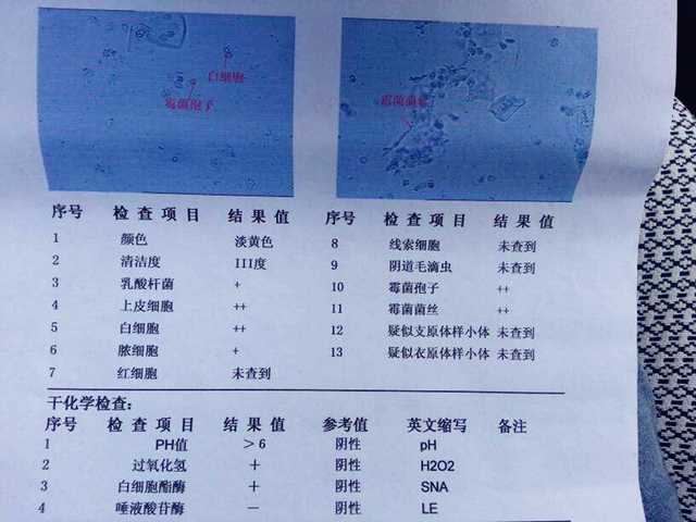 你能看懂产检单吗