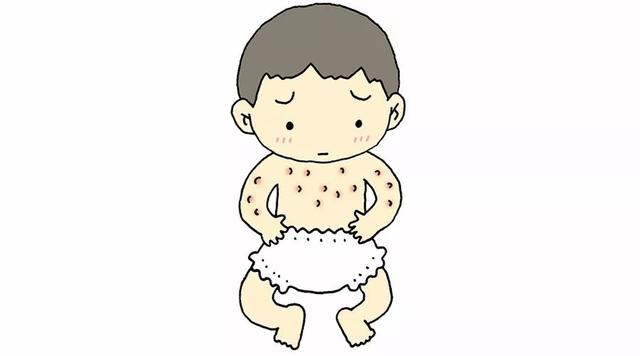 如何判断宝宝是否得了手足口病