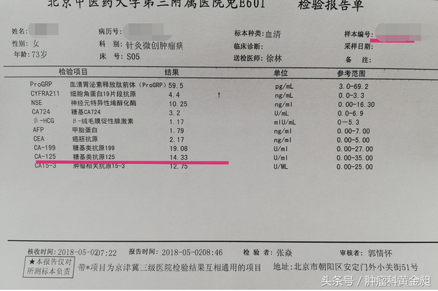 70%卵巢癌患者发现就是晚期