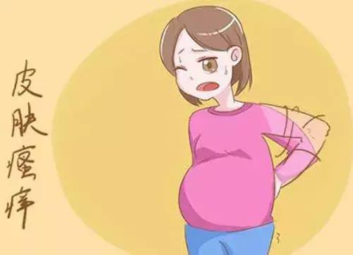 孕妇胆汁淤积的症状图图片
