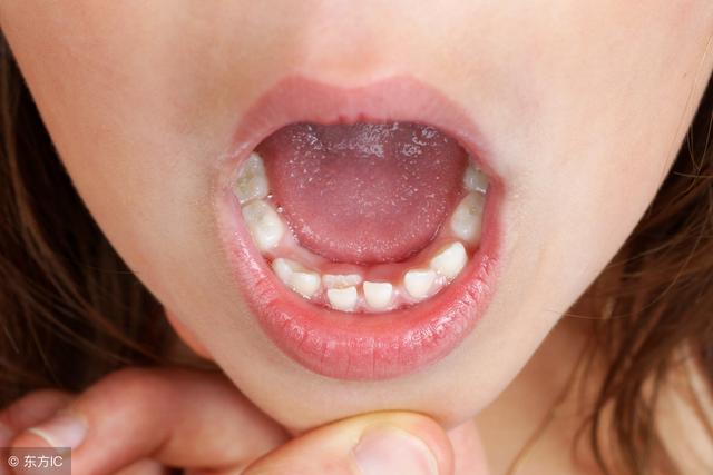 智齿一定要拔吗多少钱一颗