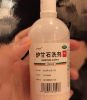 婴儿湿疹用什么药膏